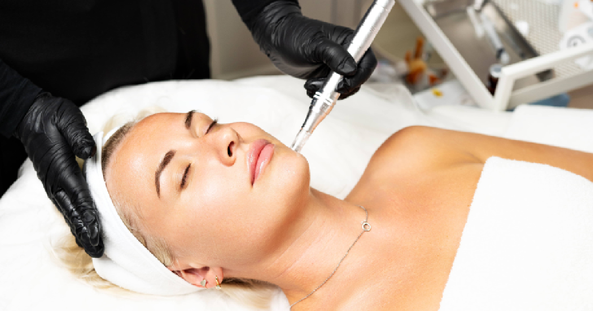 Woman receiving microneedling facial treatment while lying on a bed in Calabasas, CA
